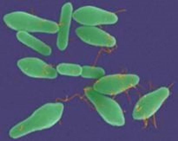 แบคทีเรีย Clostridium botulinum ที่ถ่ายรูป และตกแต่งสีด้วยวิธีการที่แตกต่างกัน