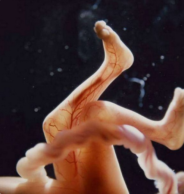 มหัศจรรย์ภาพทารกในครรภ์ 10 ภาพหาดูยาก ที่คุณเห็นแล้วจะรู้สึก...โชคดีที่ได้เกิดมา!
