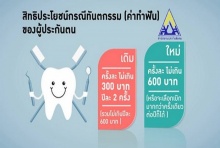 รู้ยัง! ประกันสังคม เบิกค่าทำฟัน 600 บาทครั้งเดียว