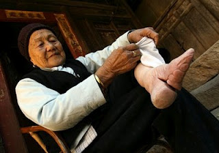 เท้าดอกบัว ( Foot Binding ) 