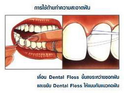 ไหมขัดฟัน...!!