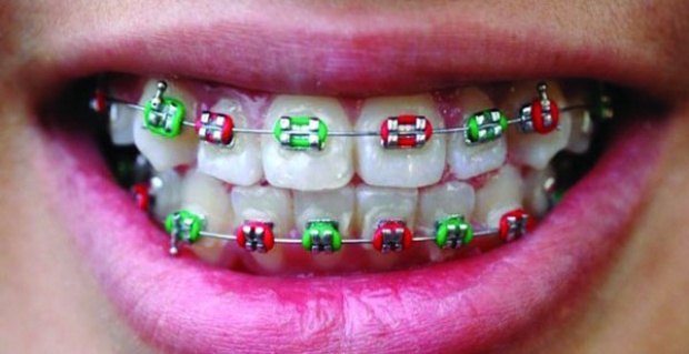 หมอฟันเล่าเรื่องชวนช็อก!! เจอคนไข้จัดฟันเถื่อนป่วยติดเชื้อ HIV !!