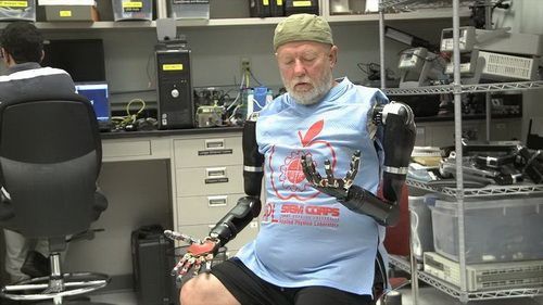 สุดยอดมนุษย์คนแรก! ที่มีแขนหุ่นยนต์ 2 ข้างที่ควบคุมด้วย “ความคิด” ได้!