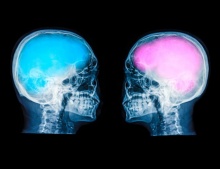 ​สมองชายกับหญิงขนาดไม่ได้ต่างกัน