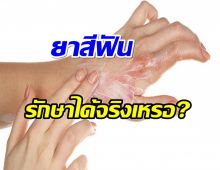 ไขข้อสงสัย ยาสีฟัน บรรเทาอาการ “แผลไฟไหม้ น้ำร้อนลวก” ได้จริงหรือ?