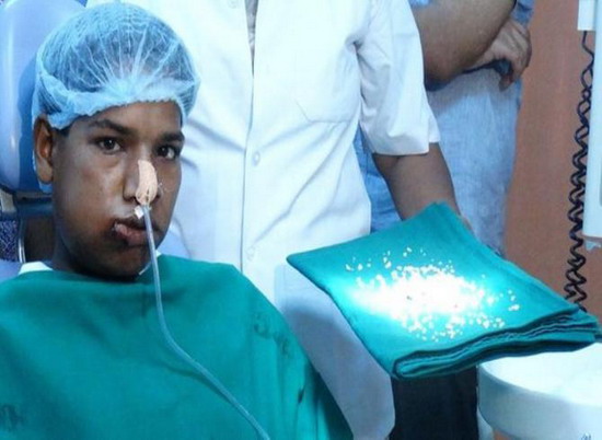 แพทย์อึ้ง!ผ่าตัดฟัน232ซี่ออกจากปากหนุ่มอินเดีย