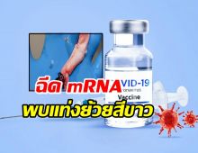 อันตรายจาก mRNA  ดูด่วนคือวัคซีนตัวไหน?