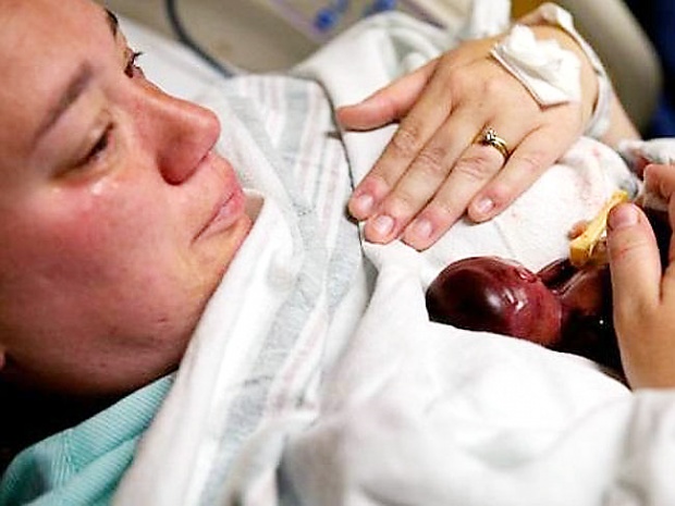 เด็กน้อยอายุครรภ์ 19 สัปดาห์ กับลมหายใจสุดท้ายในอ้อมอกแม่