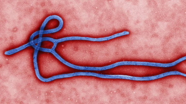 ผู้เชี่ยวชาญแนะวิธีป้องกัน อีโบลา