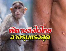 หมอธีระ เปิดข้อมูล หวั่น ฝีดาษลิง ในไทยอาจหนักกว่าทั่วโลก