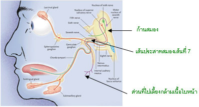 อาการหน้าเบี้ยว