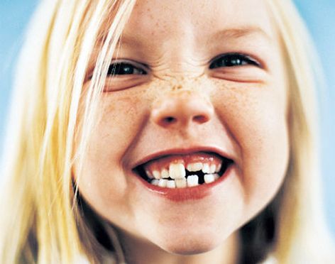 วิจัยพบ!! น้ำมันมะพร้าวป้องกันฟันผุ-โรคปากอักเสบจากเชื้อรา