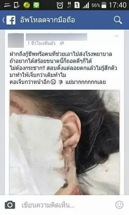 ชาวเน็ตวิจารณ์อื้อ!! สาวโวยกู้ภัยฉกสร้อยขณะเจ็บ