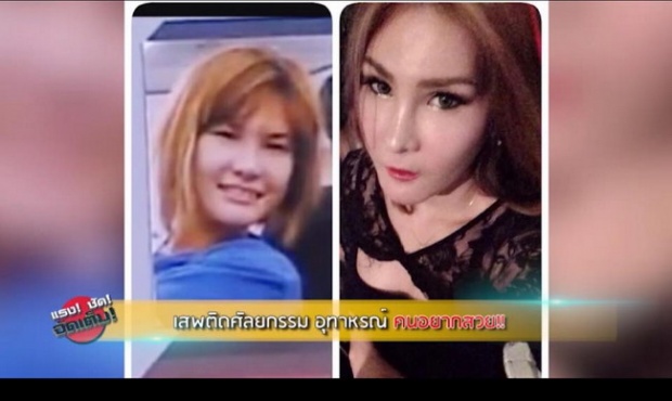 เปลี่ยนไปมาก! สาวไทยคนนี้หมดเงินทำศัลยกรรมเกือบ 5 ล้าน มาดูกันว่าคุ้มหรือไม่