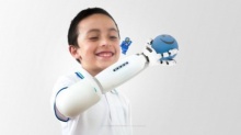 “แขนเทียมเลโก้” นวัตกรรมสร้างรอยยิ้มให้กับเด็กพิการ  