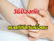 ญี่ปุ่นแนะวิธีป้องกันแบคทีเรียกินเนื้อคน หลังพบติดเชื้อกว่า 500 ราย