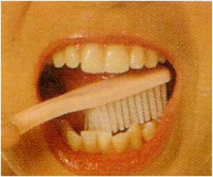 เตือนภัยอันตรายจากแปรงสีฟันเก่า บ่อเกิดโรคร้ายคาดไม่ถึง!!