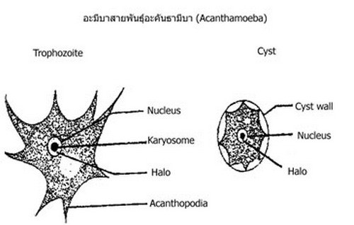 มารู้จัก อะมีบา กันเถอะ