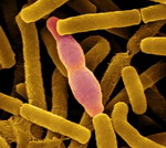 เจ้า Bacillus เพื่อนที่คอยแทงข้างหลัง