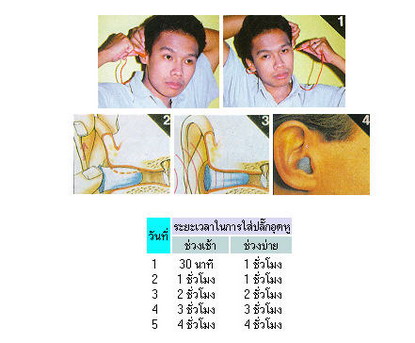 เสียงดัง...การป้องกันย่อมดีกว่า