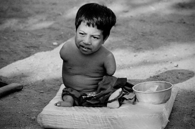 ฝนเหลือง กับพิษผลกระทบหลังสงครามเวียดนาม (ชมภาพ)