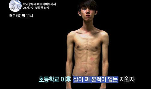 50 วันศัลยกรรมเปลี่ยนชีวิตหนุ่มเกาหลี ยางจองฮยอน