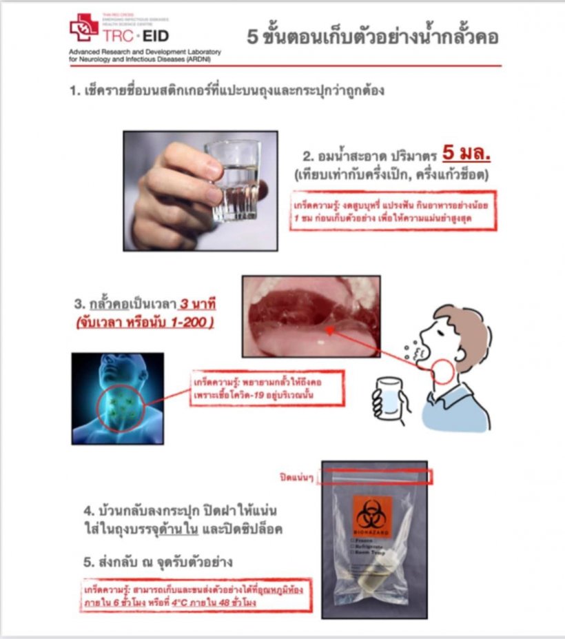 นวัตกรรมใหม่ชุดตรวจแบบน้ำกลั้วคอ ประเมินระดับความเสี่ยงติดเชื้อโควิด