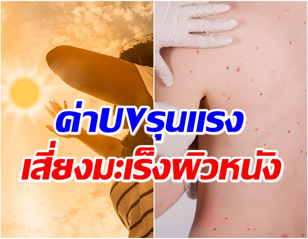 เช็กด่วน! เปิดรายชื่อจังหวัดที่มีค่าดัชนี UV สูงจัด เสี่ยงมะเร็งผิวหนัง