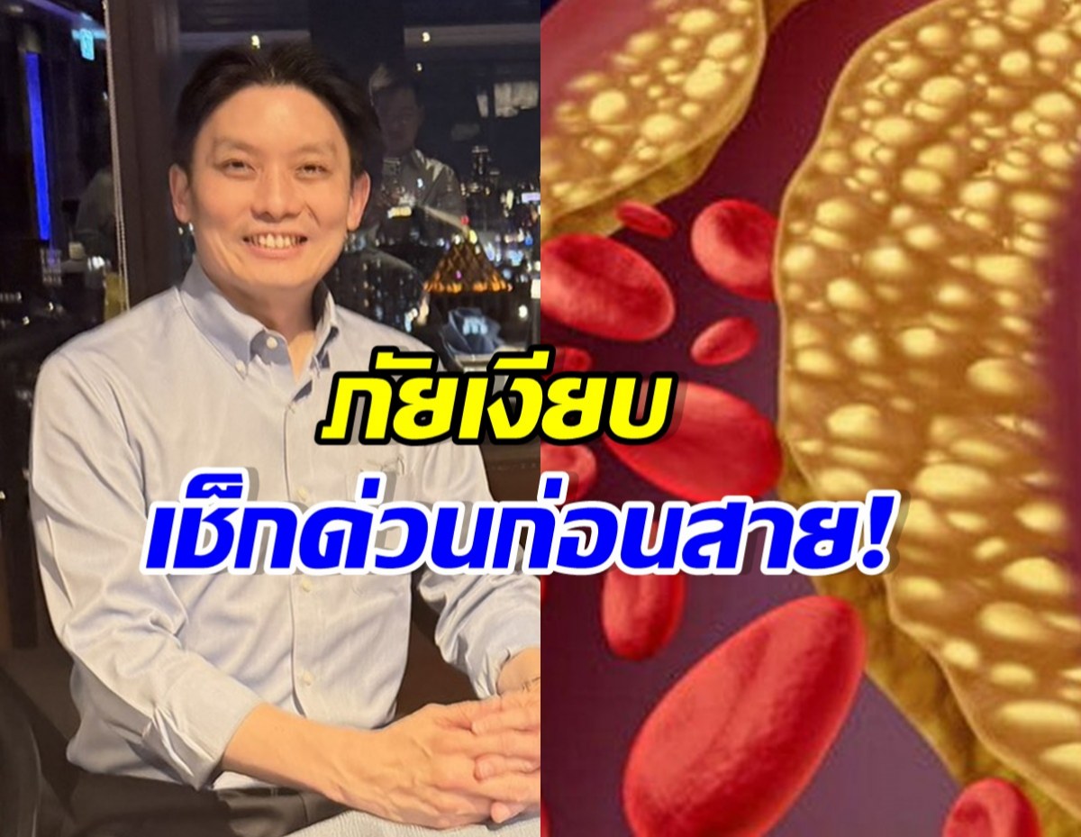 หมอวี แชร์อุทาหรณ์ เสี่ยงสโตรก-หัวใจวายไม่รู้ตัว พร้อมสูตรสู้กลับ