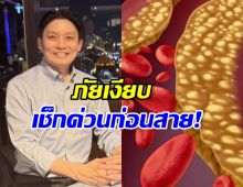 หมอวี แชร์อุทาหรณ์ เสี่ยงสโตรก-หัวใจวายไม่รู้ตัว พร้อมสูตรสู้กลับ