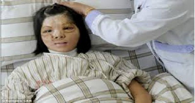 จีนเจ๋ง เปิดโฉมใบหน้าเด็กหญิง หน้าผิดปกติ หลังประสบความสำเร็จผ่าตัดปลูกถ่ายใบหน้า 
