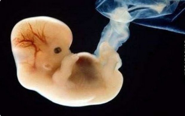 มหัศจรรย์ภาพทารกในครรภ์ 10 ภาพหาดูยาก ที่คุณเห็นแล้วจะรู้สึก...โชคดีที่ได้เกิดมา!
