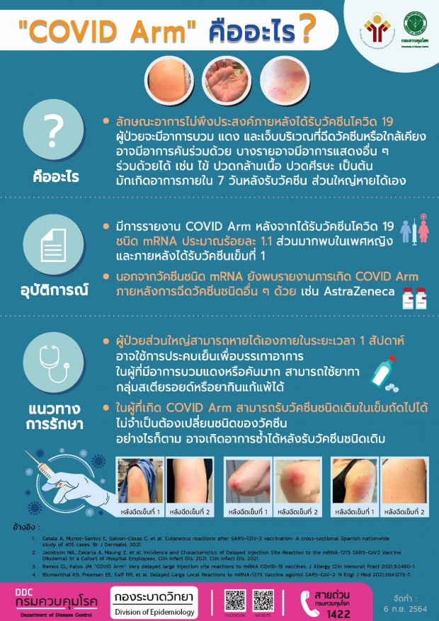 รู้จัก COVID Arm อาการไม่พึงประสงค์หลังฉีดวัคซีนชนิด mRNA