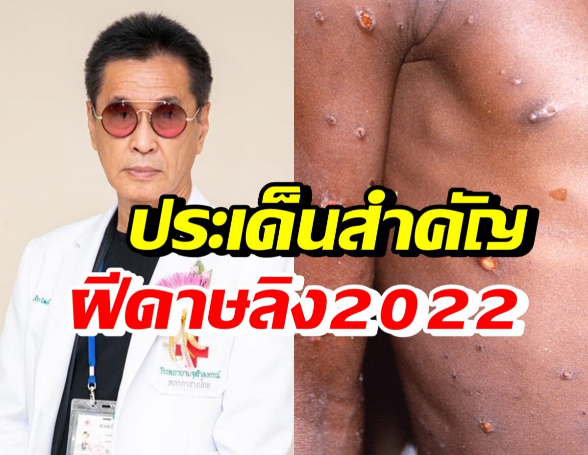 หมอธีระวัฒน์ ให้ความรู้เกี่ยวกับโรคฝีดาษลิง ที่เปลี่ยนใหม่2022