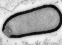 พบไวรัสตัวใหญ่อายุกว่า 30,000 ปี