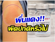 รู้จัก COVID Arm อาการไม่พึงประสงค์หลังฉีดวัคซีนชนิด mRNA