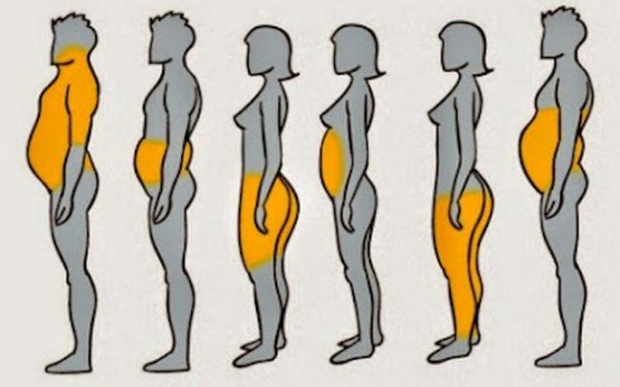 เช็ก 6 ลักษณะของร่างกาย ที่ทำให้รู้ว่าความอ้วนของคุณเกิดจากอะไร