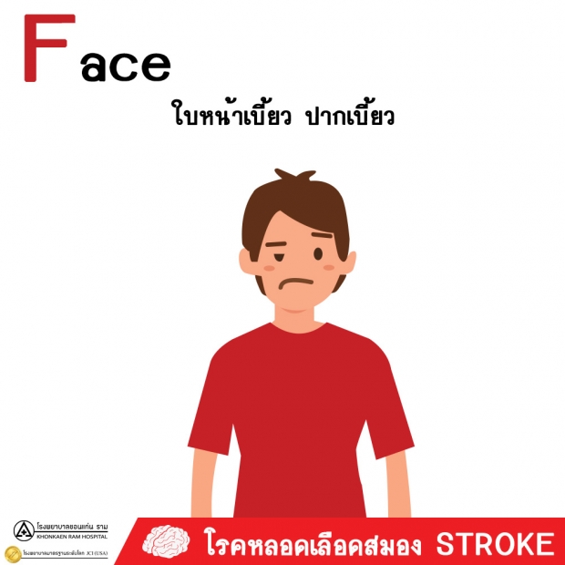 รู้ก่อนเป็น! โรคหลอดเลือดสมอง อันตรายถึงชีวิตอันดับ3ของไทย