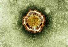 พบไวรัสใหม่ คล้ายตระกูลซาร์สระบาดจากคนสู่คนในอังกฤษ