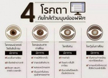 มารู้จัก 4 โรคตา ภัยใกล้ตัวมนุษย์ออฟฟิศ