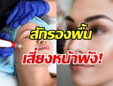 เตือน! เทรนด์ฮิต“สักรองพื้น” มาตรฐานต่ำเสี่ยงโรคร้าย ทั้งติดเชื้อไวรัส-HIV