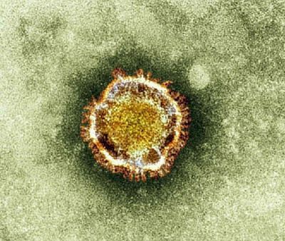 พบไวรัสสายพันธุ์ใหม่ ร้ายแรงกว่าซารส์ หวั่นระบาดทั่วโลก