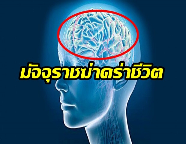 โรคหลอดเลือดสมอง มัจจุราชเงียบ! 3 ชม.ครึ่ง ชีวิตเปลี่ยน