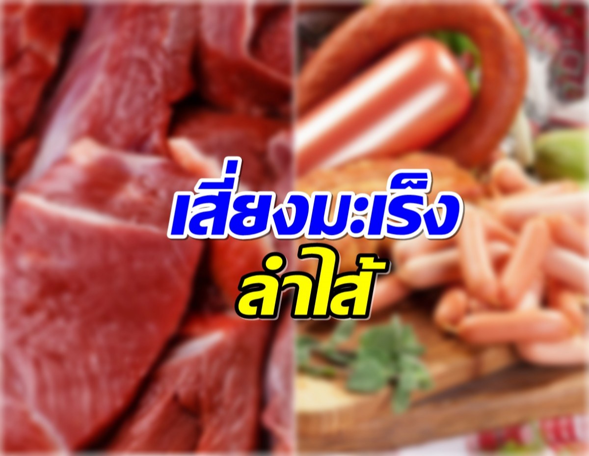 หมอเตือน กินอาหาร 2 ประเภทนี้ เสี่ยงมะเร็งลำไส้! 