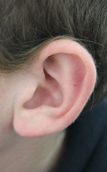 วิธีการดูแลรักษา สุขภาพหู 