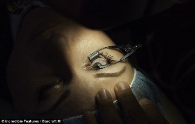 สาวจ้างหมอฝังทองคำขาวรูปหัวใจในดวงตา แพทย์เตือนอันตราย 