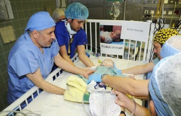 ผ่าตัดฝาแฝดสยาม - ทีมแพทย์แยกร่าง 2 ทารก!