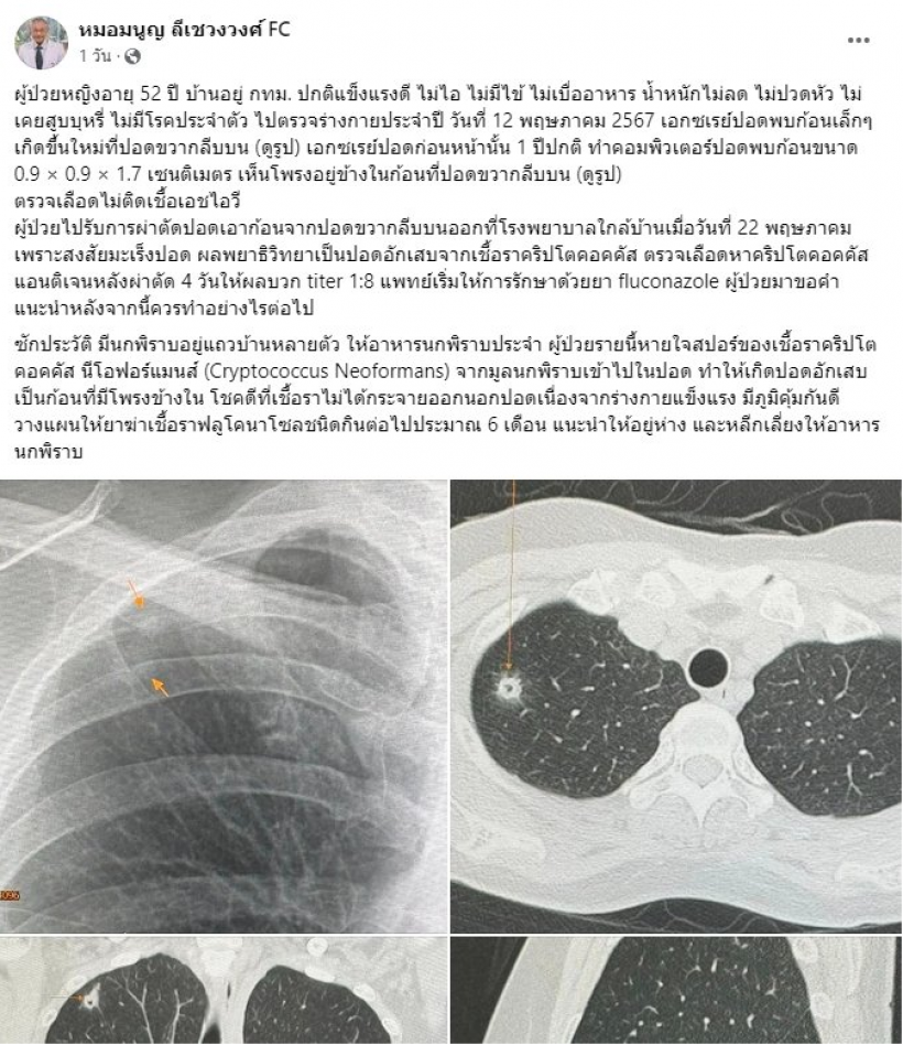 ให้อาหารนกพิราบ! เสี่ยงปอดอักเสบเพราะขี้นก