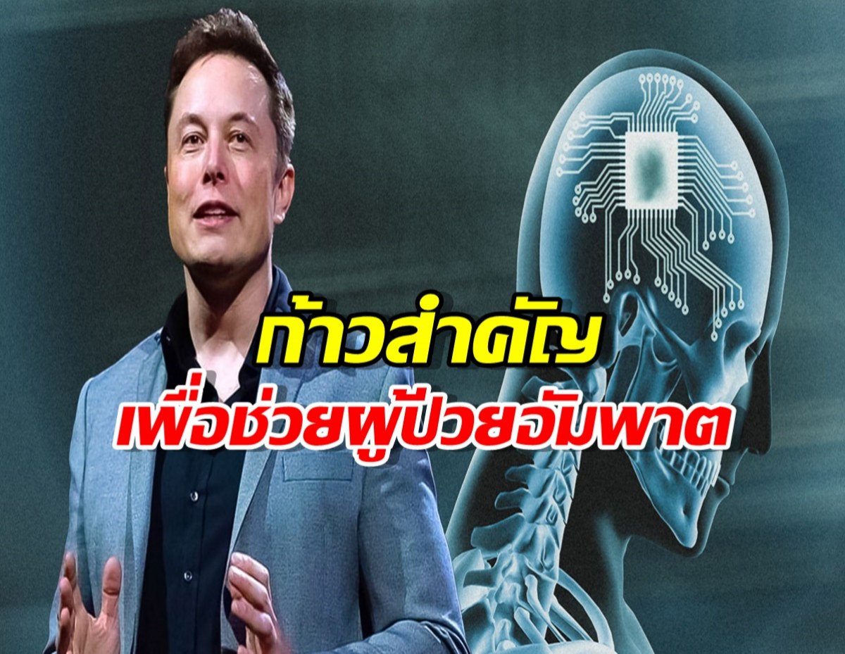 ประวัติศาสตร์! Neuralink ของอีลอนมัสก์ ฝังชิปสมองให้ผู้ป่วยสำเร็จ