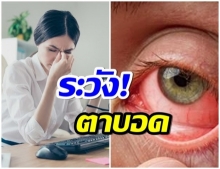 โรคตาอันตราย ยุคนิว นอร์มอล อาจทำตาบอด 